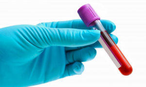 test sierologico covid-19